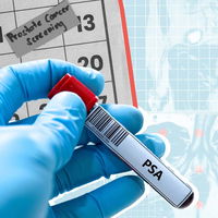What to know about prostate cancer